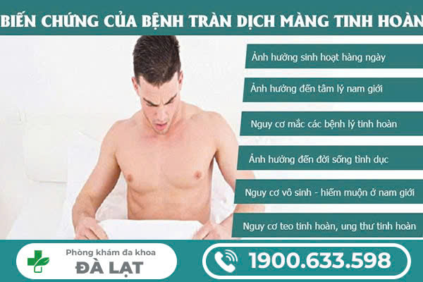 Hình ảnh minh họa